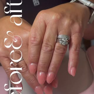 Before and after nail transformation